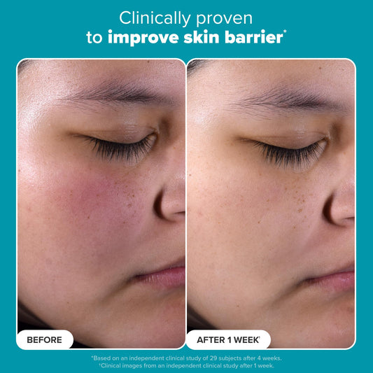 Paula's Choice SKIN PERFECTING 2% BHA Liquid Salicylic Acid Exfoliant - Blackheads & Pores, 4oz