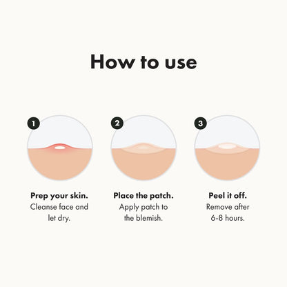 Hero Mighty Patch Original: Hydrocolloid Pimple Patch for Shrinking Zits in 1 Use (36 Ct)