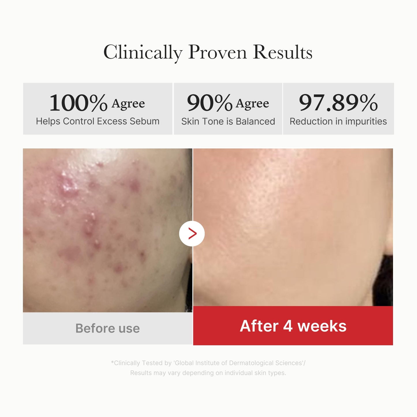 Medicube Zero Pore Pads 2.0 | Deep Pore Cleansing, Sebum Control & Smooth Skin | Korean Skincare for All Skin Types (70 Pads)