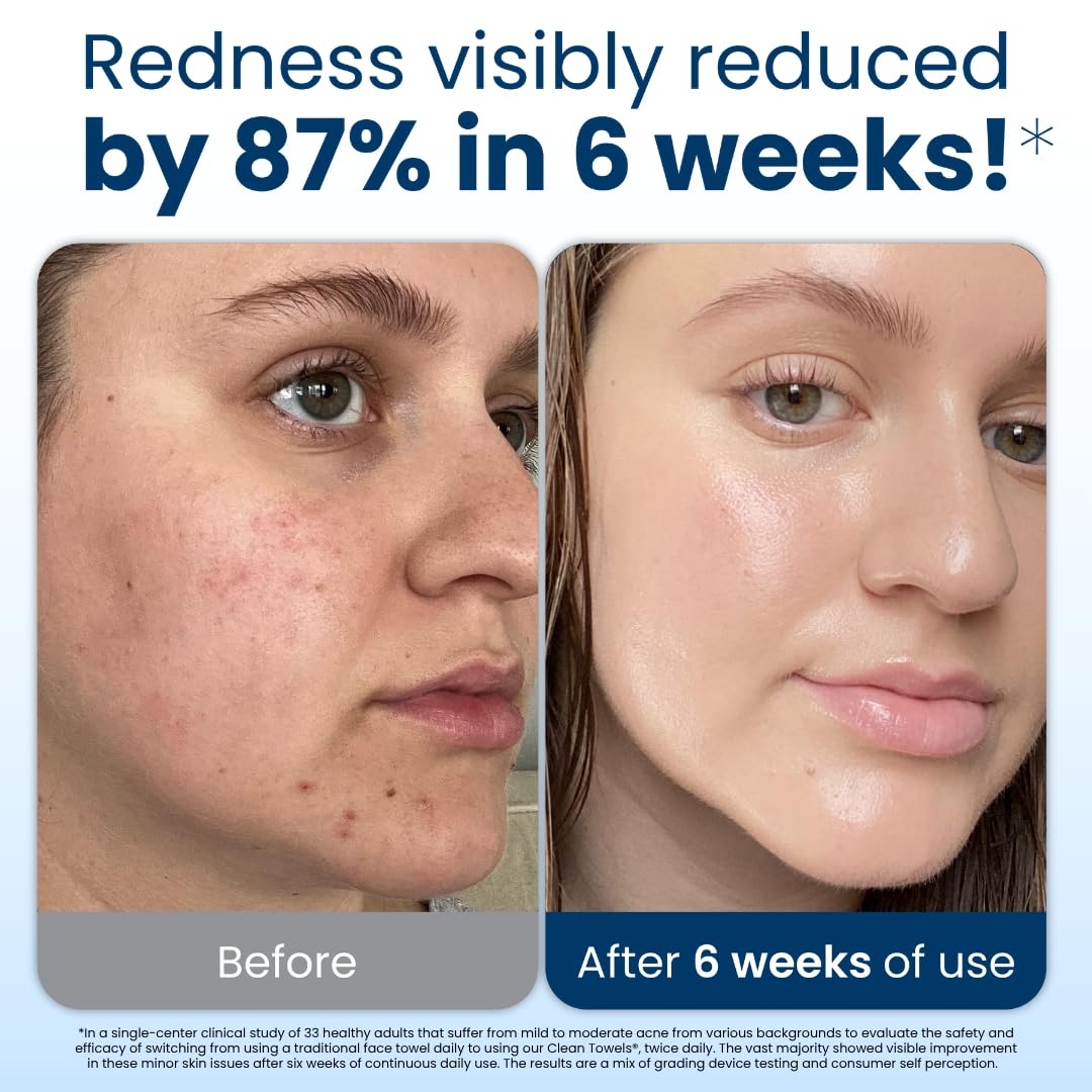 Clean Skin Club Clean Towels XL: 100% Biobased Disposable Face Towel for Clearer Skin