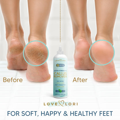 Extra Strength Foot Callus Remover Gel | Fast-Acting Pedicure Tool