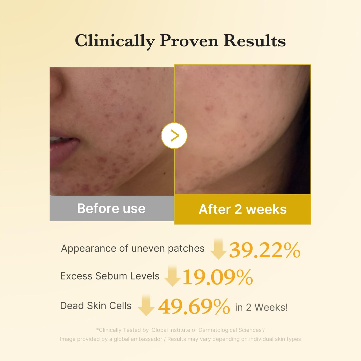 Medicube Zero Pore Pads 2.0 | Deep Pore Cleansing, Sebum Control & Smooth Skin | Korean Skincare for All Skin Types (70 Pads)