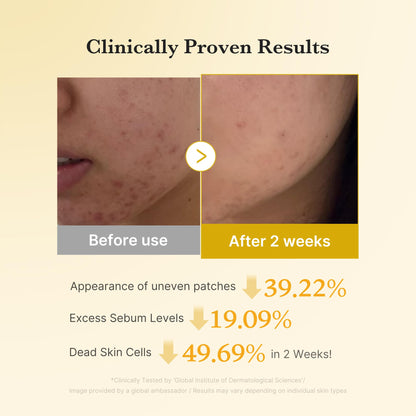 Medicube Zero Pore Pads 2.0 | Deep Pore Cleansing, Sebum Control & Smooth Skin | Korean Skincare for All Skin Types (70 Pads)