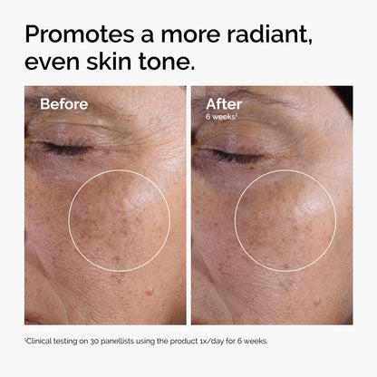 The Ordinary Glycolic Acid 7% Exfoliating Toner - Brightens & Smoothes Skin Tone, 3.4 Fl Oz