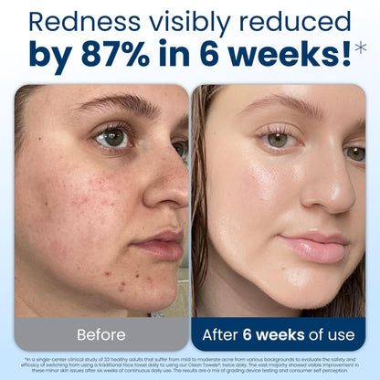 Clean Skin Club Clean Towels XL: 100% Biobased Disposable Face Towel for Clearer Skin