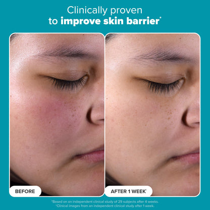 Paula's Choice SKIN PERFECTING 2% BHA Liquid Salicylic Acid Exfoliant - Blackheads & Pores, 4oz